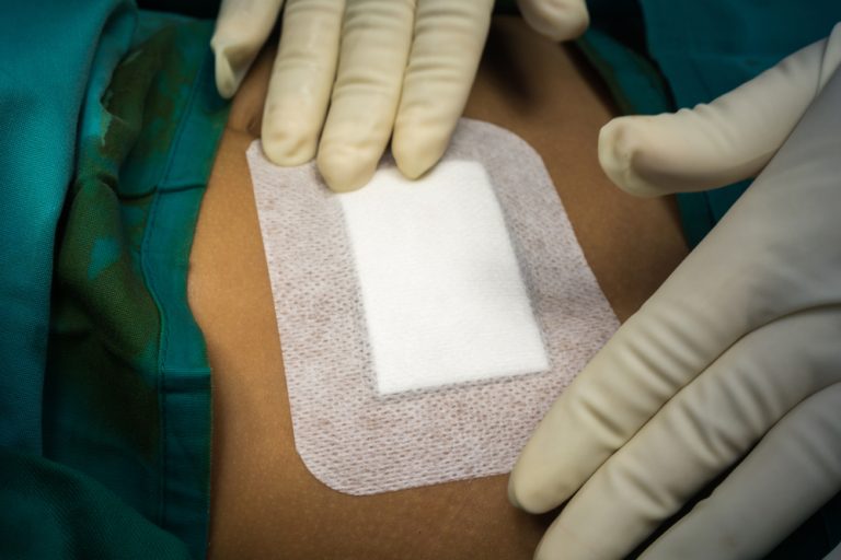 wound dressing being applied with gloves